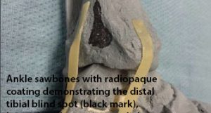 New Foot and Ankle Publications