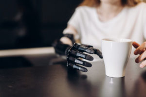 OrthoCarolina Hand Surgeons Discover Children, Adults Born without Hand Have Brain Functionality to Control Advanced Prosthetics